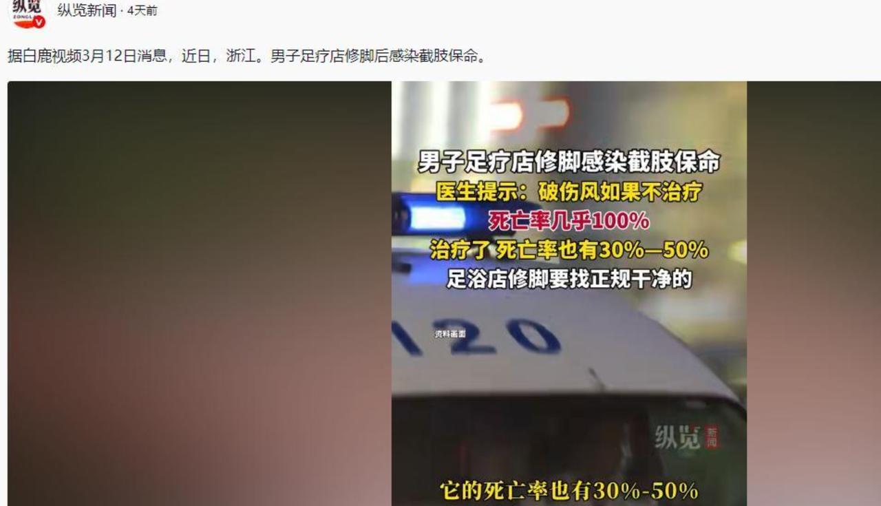 “什么？截肢！这么小的一个伤口让我截肢？”一男子在医院愤怒的对着医生吼道。3月