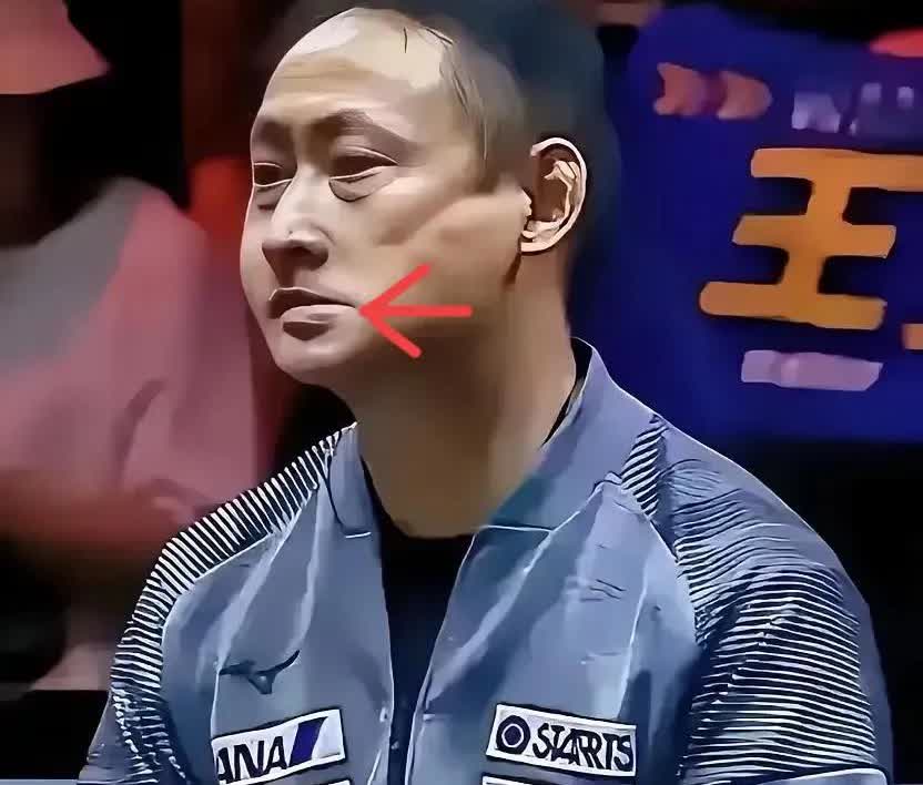 张本宇气的嘴都歪了，但不是因为张本兄妹都结束了，而是因为他一算账，这一趟