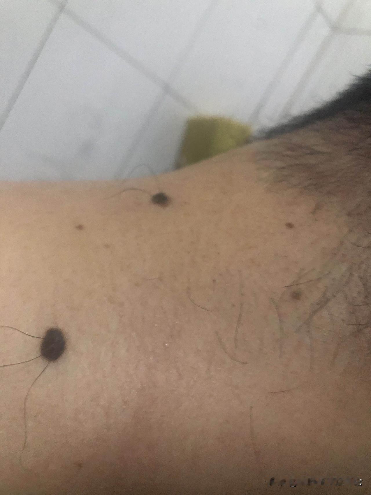 说实话，这医院真的是不能去，不光是要让你花很多钱，还能被医生吓一顿。昨天我老