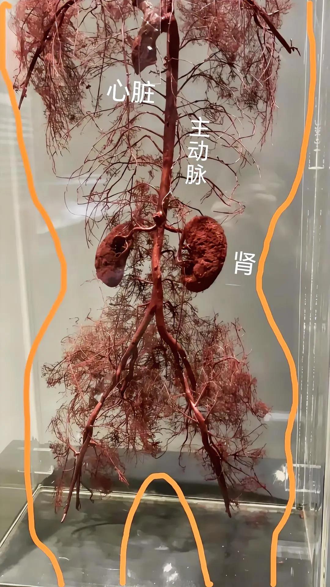 血管！[无奈吐舌]别光看图，还要看字！这是大体老师经过特殊工艺，去除了肌肉骨骼