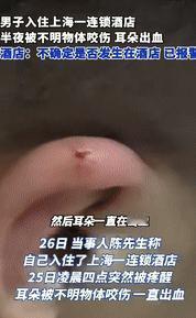 “倒大霉了！”9月26日上海一男子半夜在酒店休息时，突然感觉有东西在咬他耳朵，男