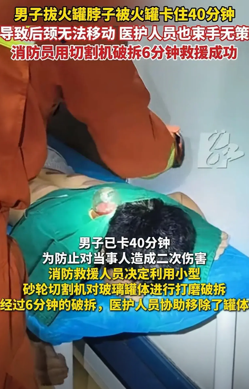 “太离谱了！”湖南浏阳，男子去拔火罐，没想到火罐把脖子卡住，根本拔不下来，医生也