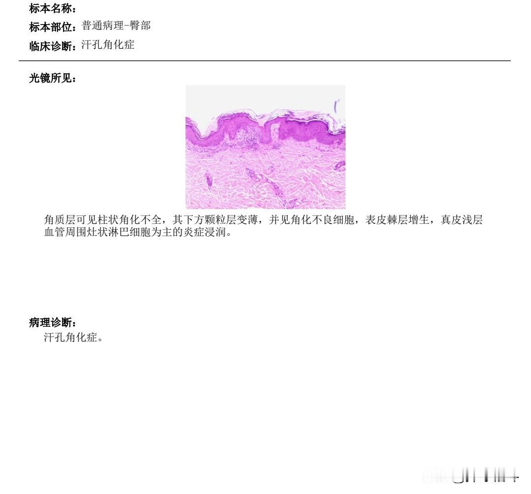 2025年6月中旬，我驱车前往南京中国医学科学院皮肤病医院就诊，主任医生建议再做