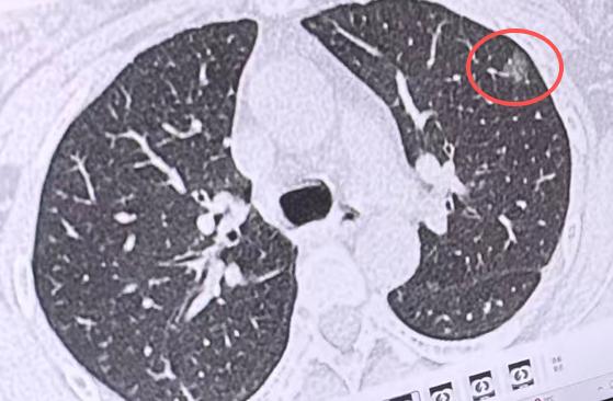 在门诊坐诊这么多年，我最常遇到的情况就是，有人一查出身体里长了结节，立马就慌了神