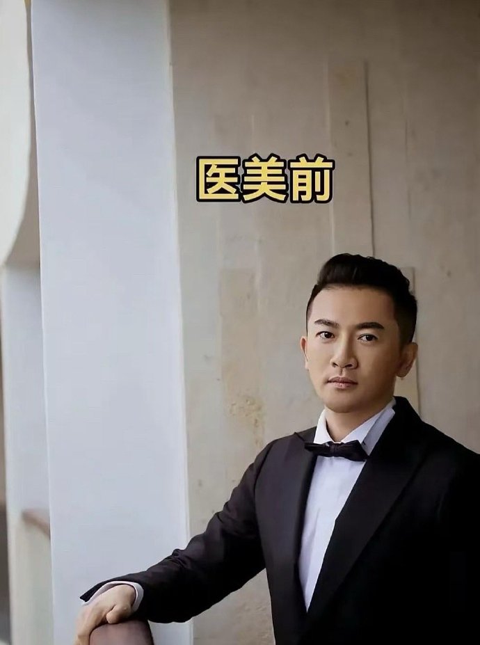 不得不说，苏有朋为什么对自己脸这么狠！跟以前相比，简直判若两人了