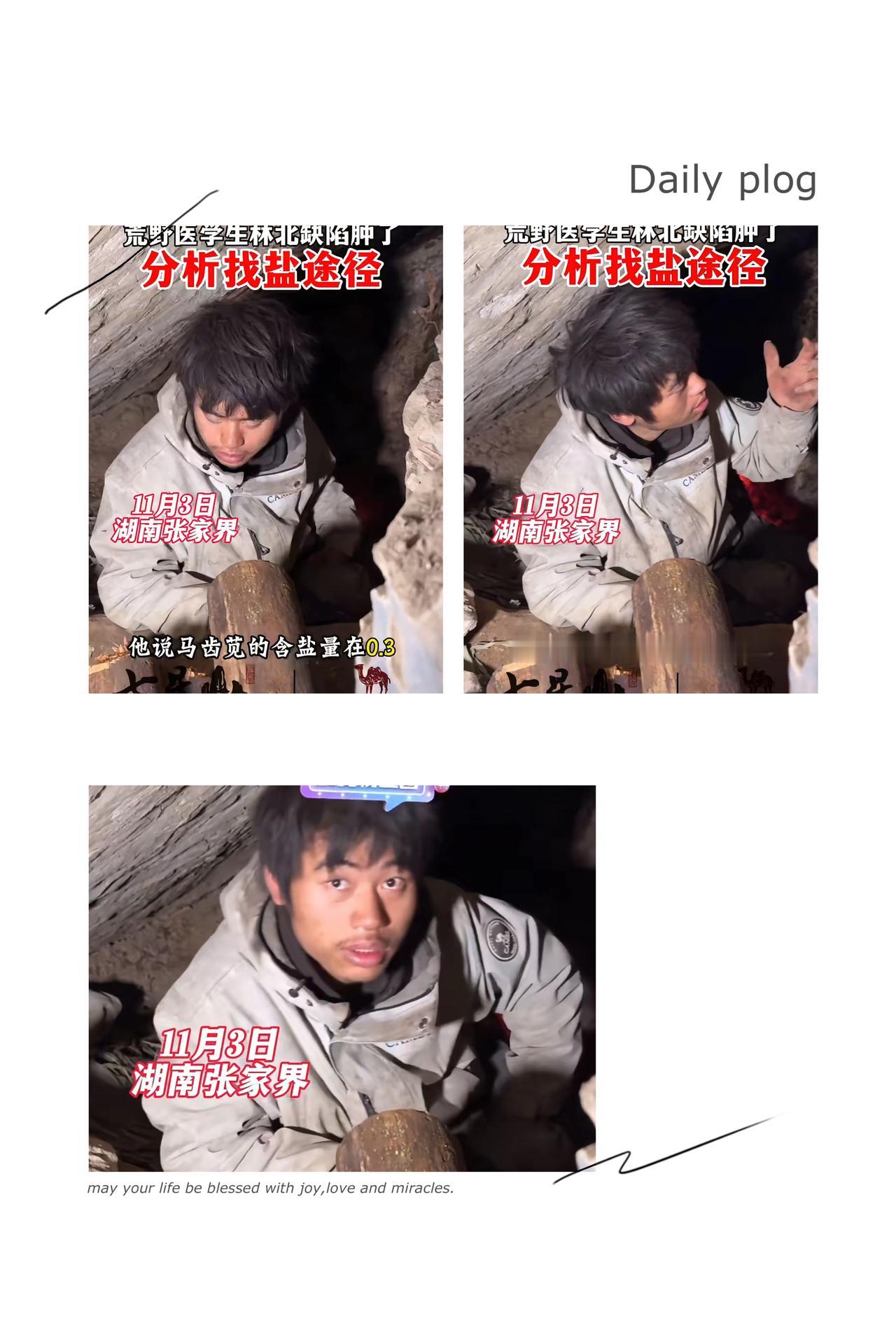 好家伙！林北这次在七星山骆驼杯荒野求生真是让人捏把汗，身体都出现水肿了还硬扛着。