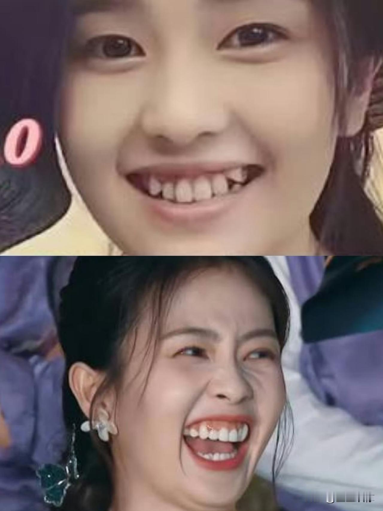 白鹿和杨紫同是原生乱牙，大笑瞬间的气质差太明显了。白鹿五官全放开，眉眼挤成锐角，