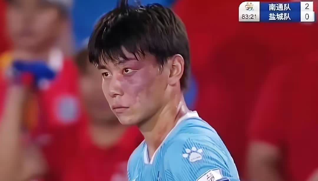 一边是“苏超”球员业余选手“青面兽”庞志超坚毅的眼神；一边是国足队员染黄毛、