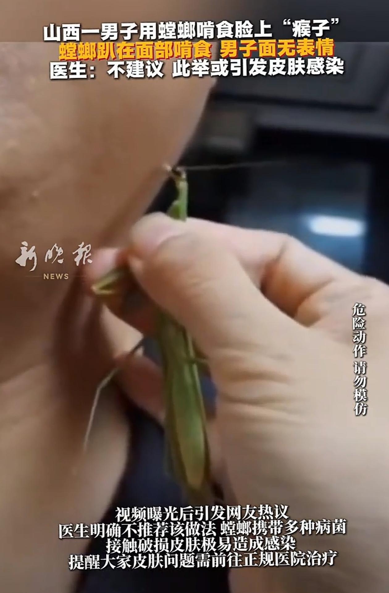 “心不是一般的大！”山西，男子脸上长了个痦子，可他不去医院，反而用土办法，抓了只