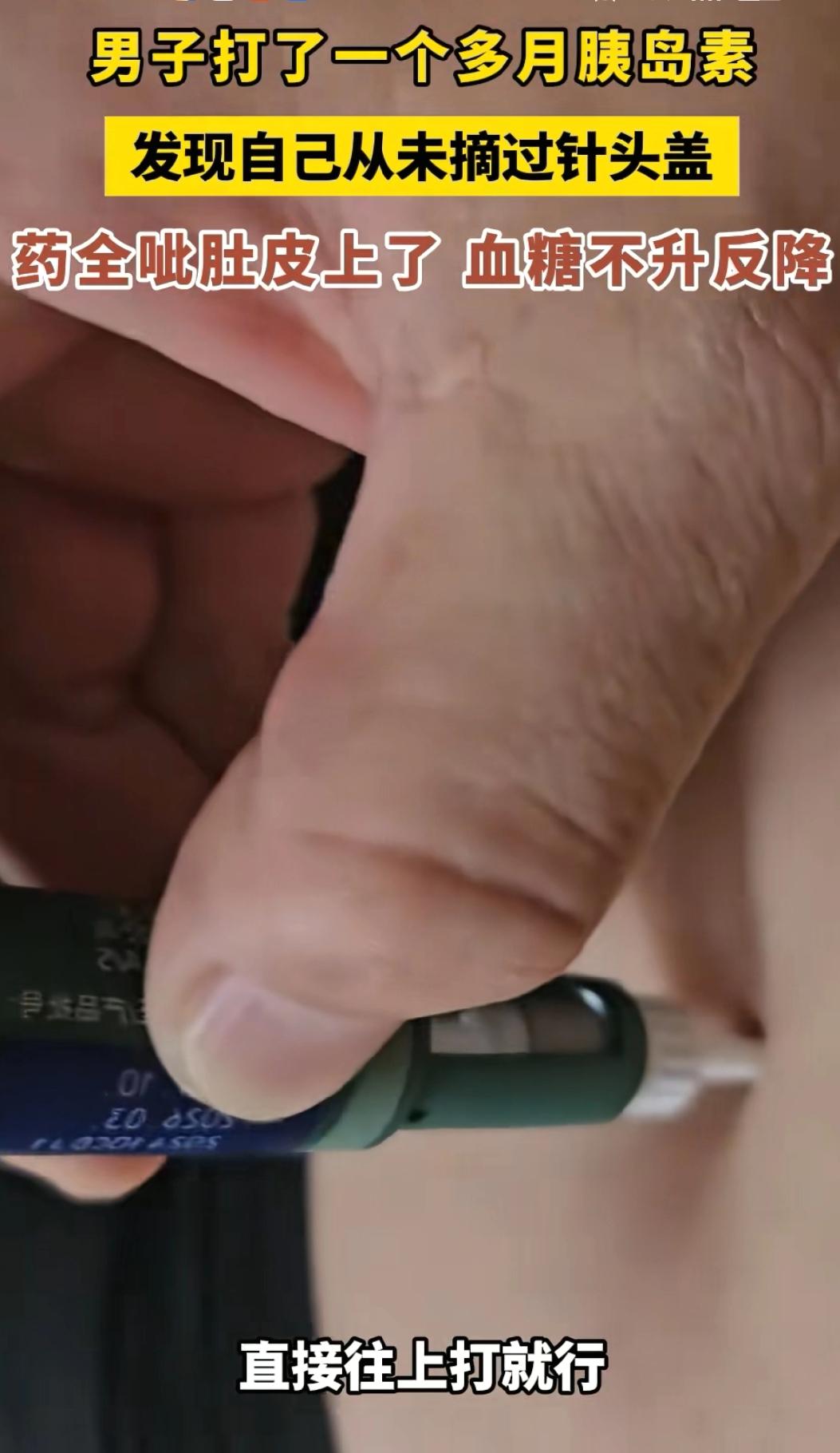  离了个大谱！大哥坚持打胰岛素，结果内盖没开全打空气，血糖还降了！哈哈..