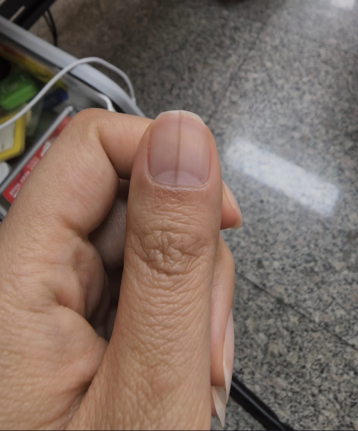 手上有这3个变化，一定要小心：1，指甲上出现一条纵向黑线，宽度超过3毫米，边界越来越不规则，或者指甲