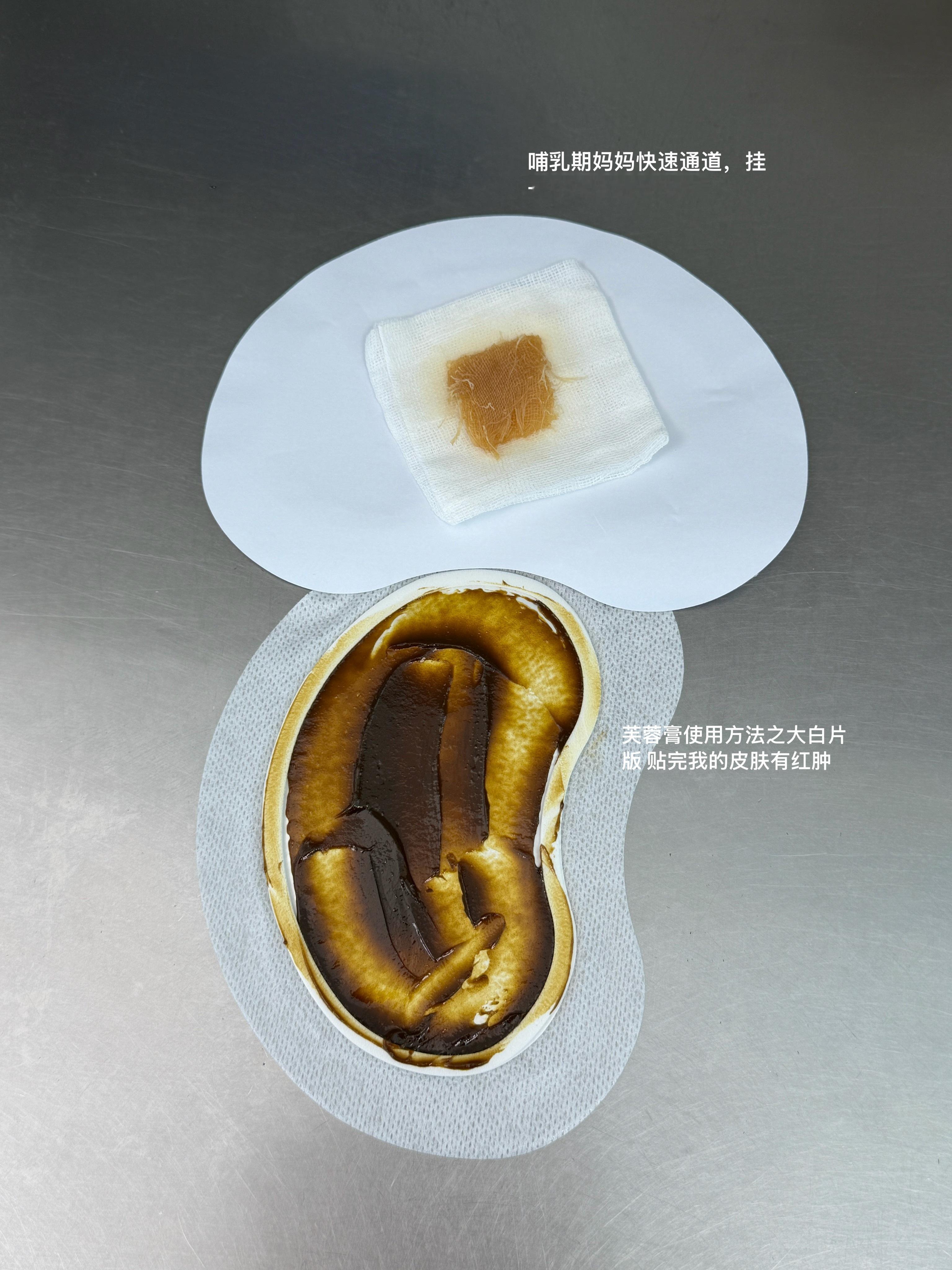 刚刚喂奶发现多了一个出奶孔！开心！堵奶母乳喂养
