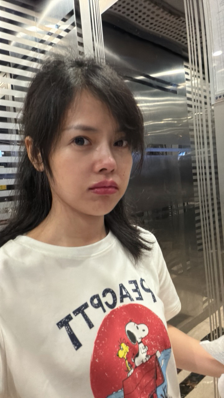 晚上没带娃，过来美容院做了嘴唇。。。秒变香肠嘴，