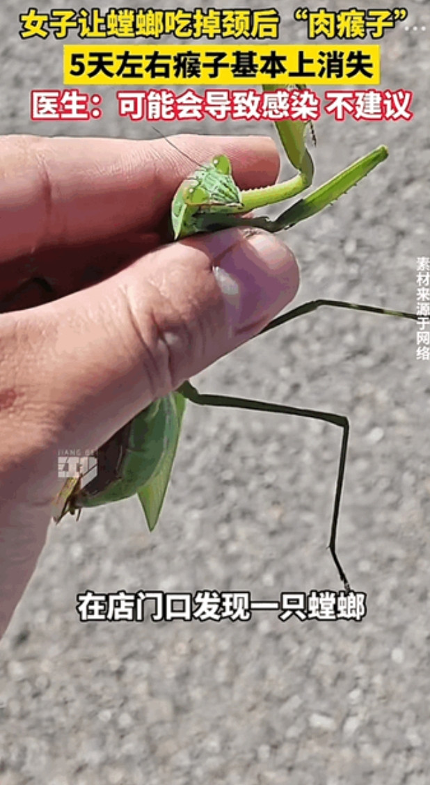 这绝对是狠人！山西，女子相信偏方让螳螂吃掉自己颈部长得肉瘊子，只是感觉螳螂啃的时