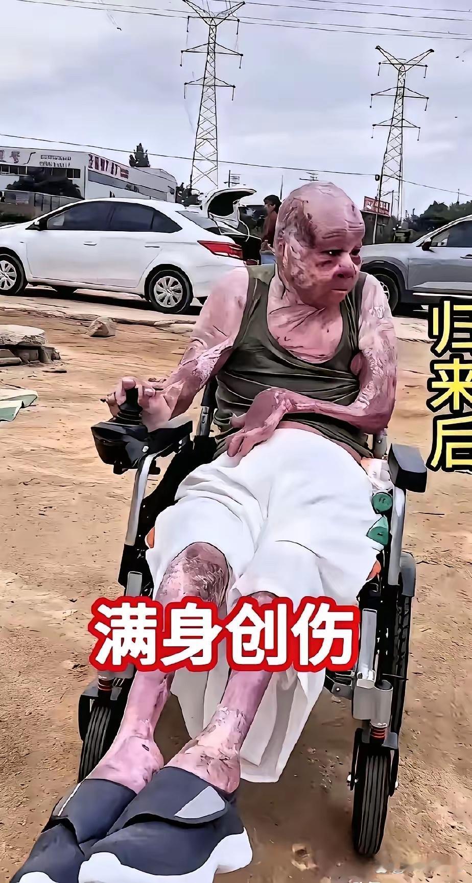 泪目了！相信不用说你也知道，这个曾经帅气的小伙，是一名消防员。他的父母得