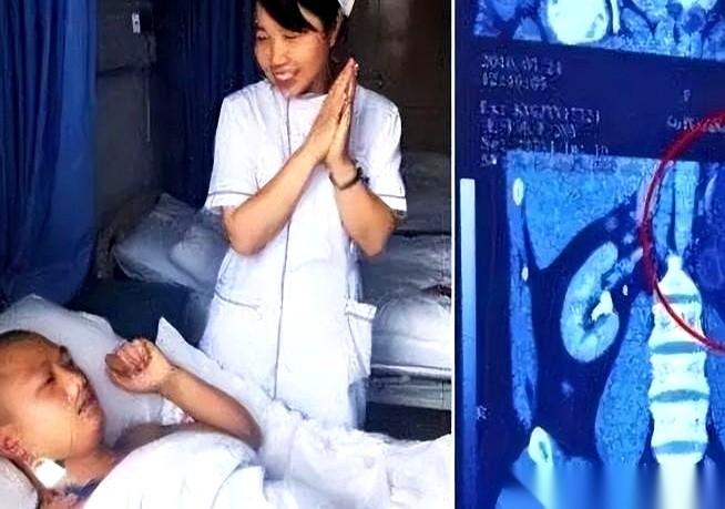 去医院看个腰酸，CT拍完医生揉了揉眼睛，指着片子说：“哥们，你肚子里有四个肾。