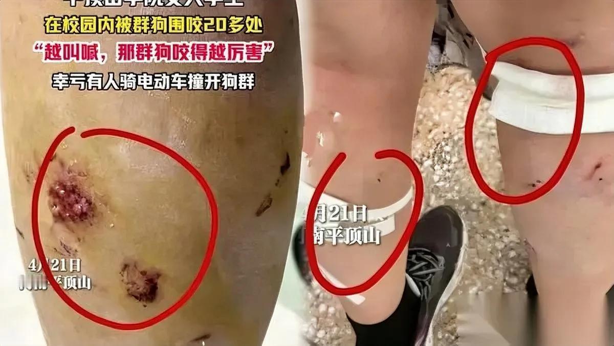 爱狗人士哑了没人出声了当年逼走保安的报应来了。两年前平顶山学院保安清