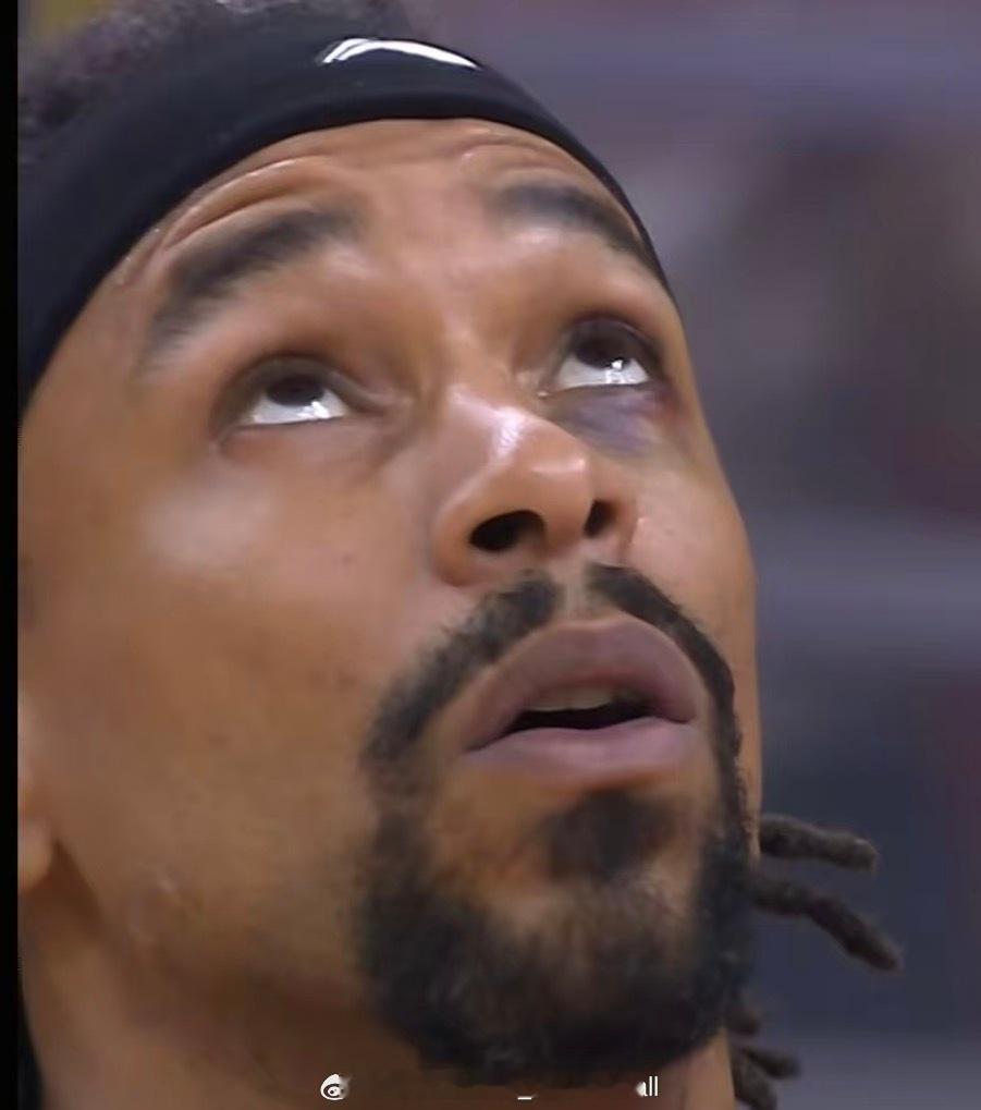 这眼睛是咋地了，比赛也没看到受伤啊