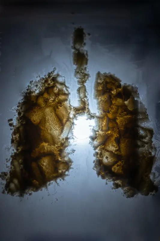 癌症晚期治愈是个复杂问题。总体来说，晚期癌症治愈概率较低。像肺癌、肝癌、胰腺癌这