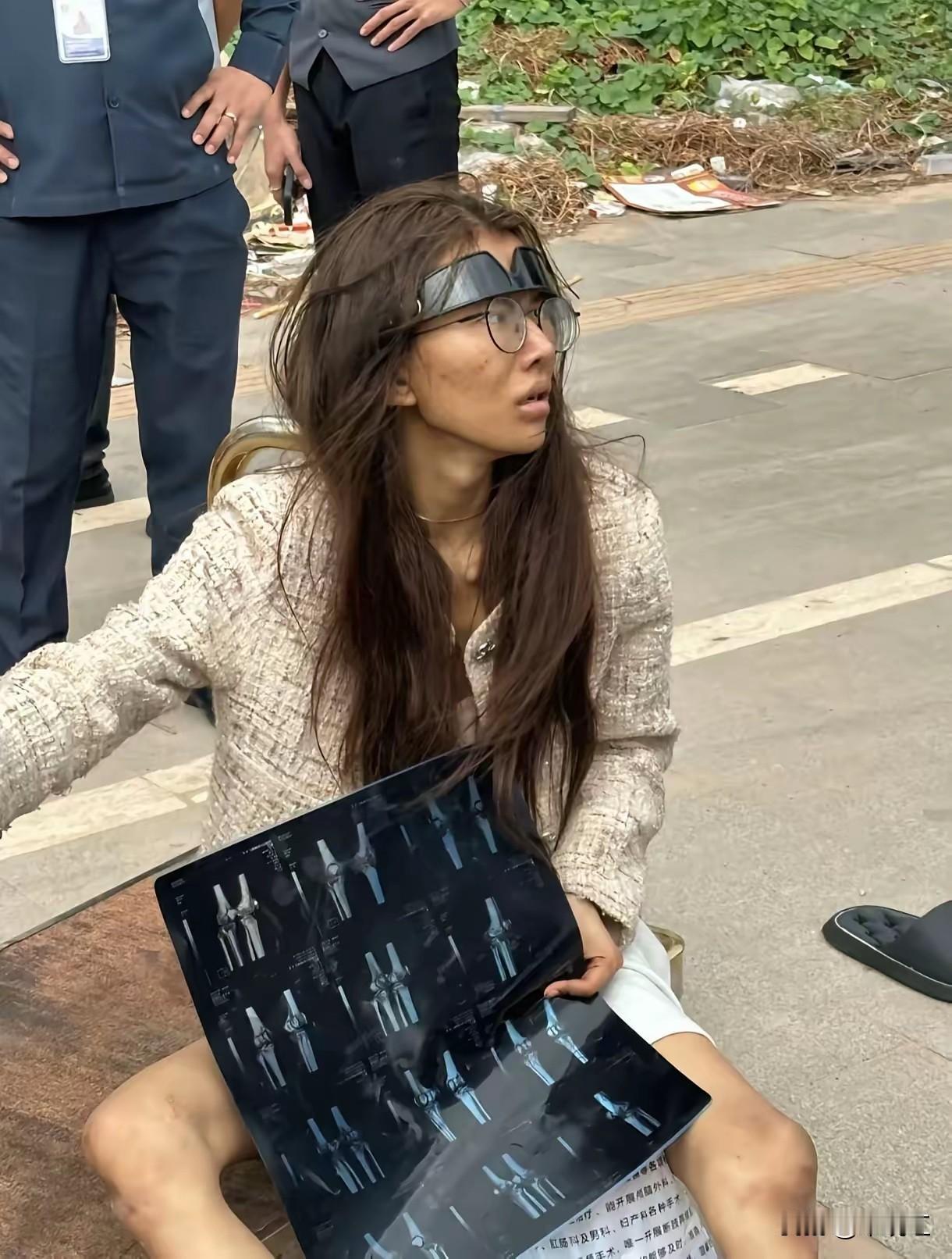 这位20岁的女孩，曾经光鲜艳丽，如今憔悴不堪，流落街头。经院方检查，吴某桢被诊断