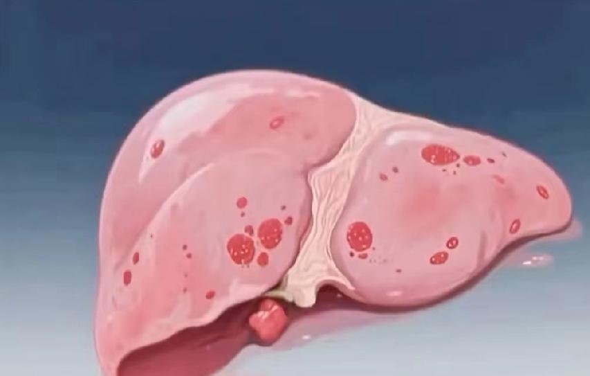 肝气郁结是中医概念，外在表现较为多样。情绪方面，常出现情绪低落、抑郁寡欢，容