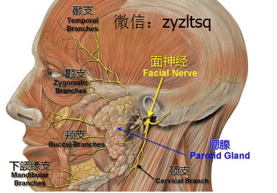 特发性面神经麻痹中医全面解答