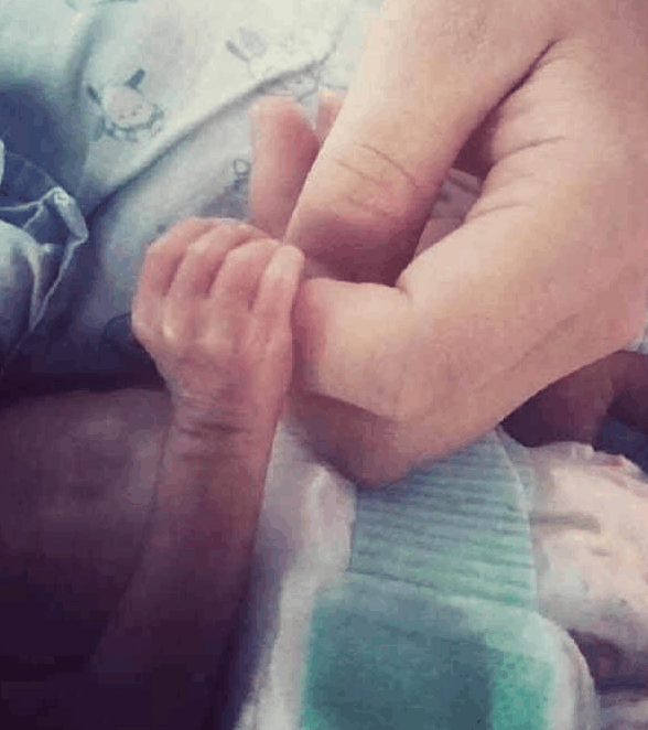 孕妈怀孕三月得了阑尾炎, 生下了一个迷你小宝宝