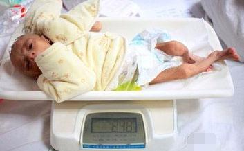 6个月宝宝便便像喷水, 瘦成皮包骨, 没想到都是母乳惹的祸