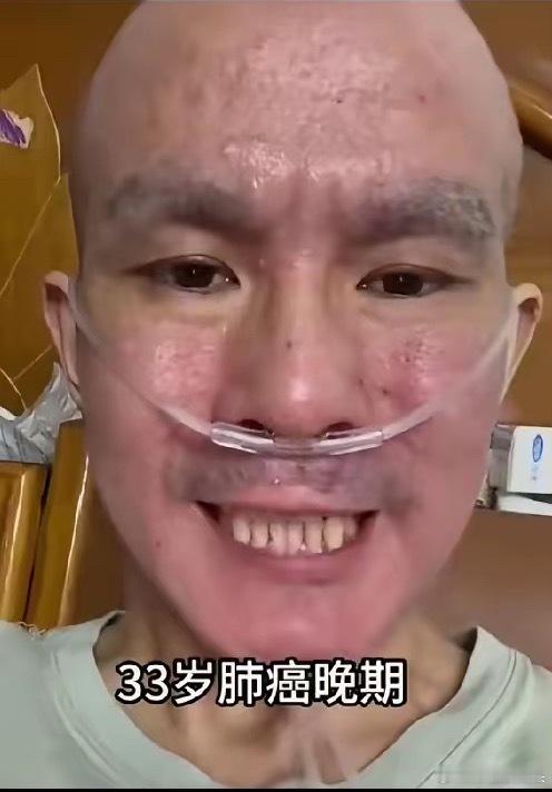 一位男子三十三岁，因为一次感冒咳嗽不好，将近一个月，他以为年轻没有在意，后来喉咙