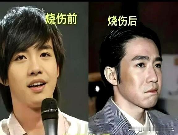 俞灏明拍《惊天救援》爆破戏时，有个男人在片场连蹲三天盯安全设备。谁也没想到，