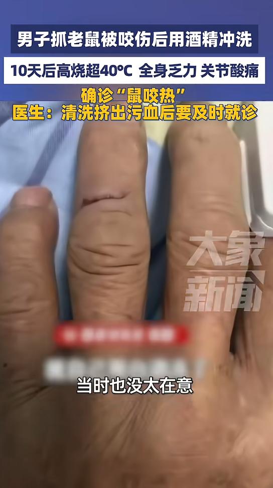 “悲剧还是发生了！”近日，广东深圳，一男子在粘鼠板上发现一只老鼠，本想去抓住它，