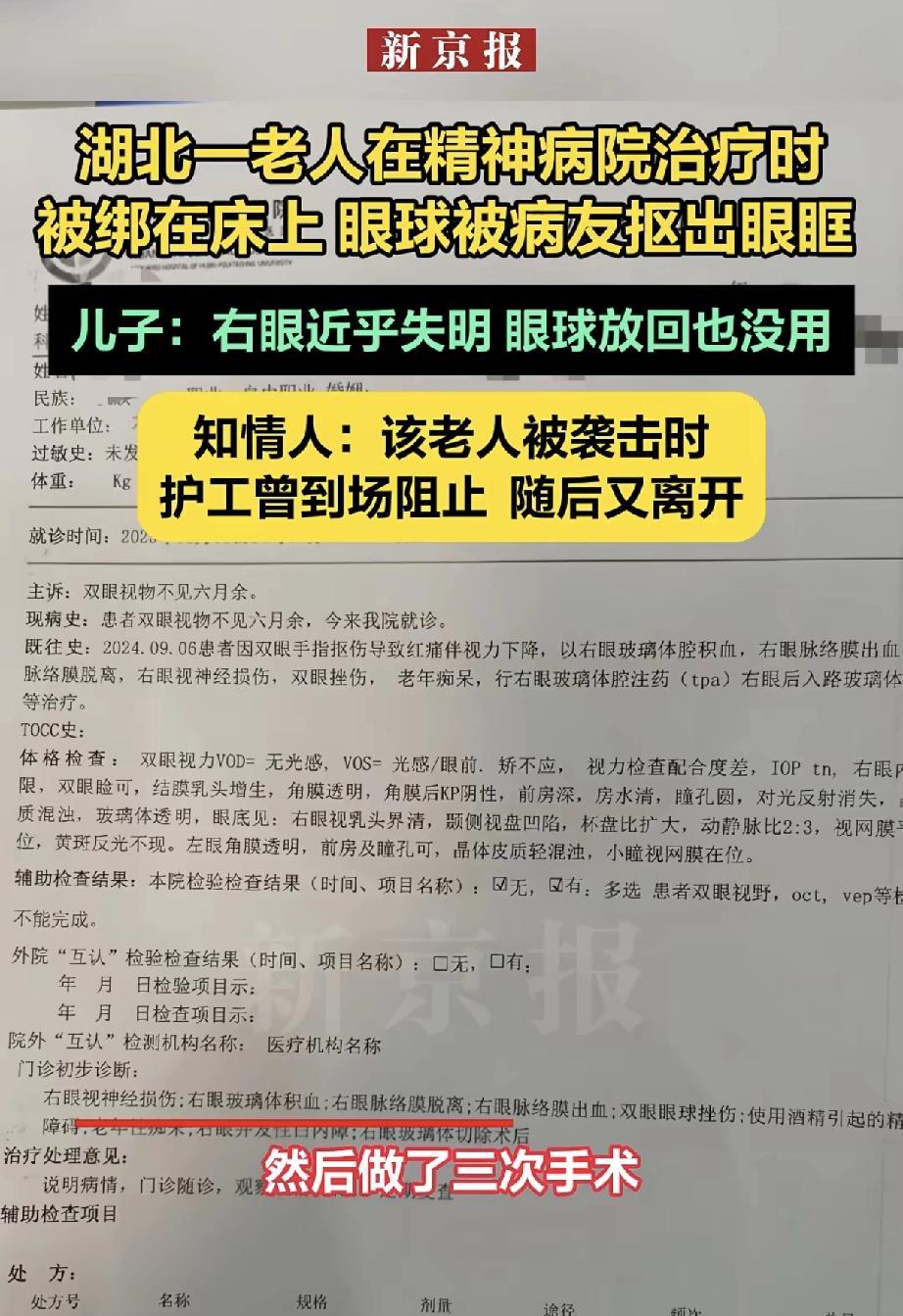 2025年6月5日，湖北黄石市民王先生反映，2024年9月，其68岁因老年性痴呆