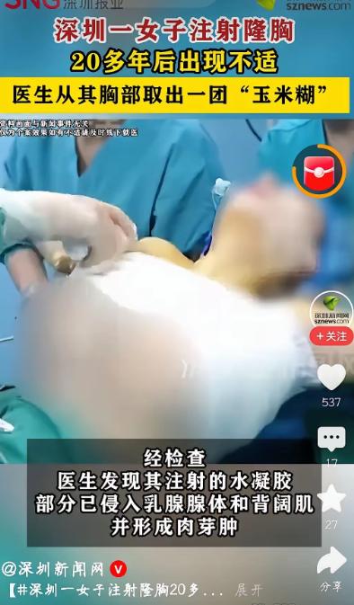 太吓人了，6月25日深圳新闻网报道，深圳一个王女士，因为胸部持续不舒服去医院。结
