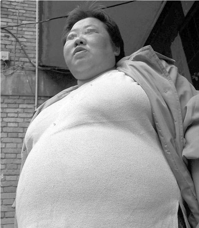 肚子莫名其妙的“跳动”, 她以为自己胖, 进了产科恍然大明白