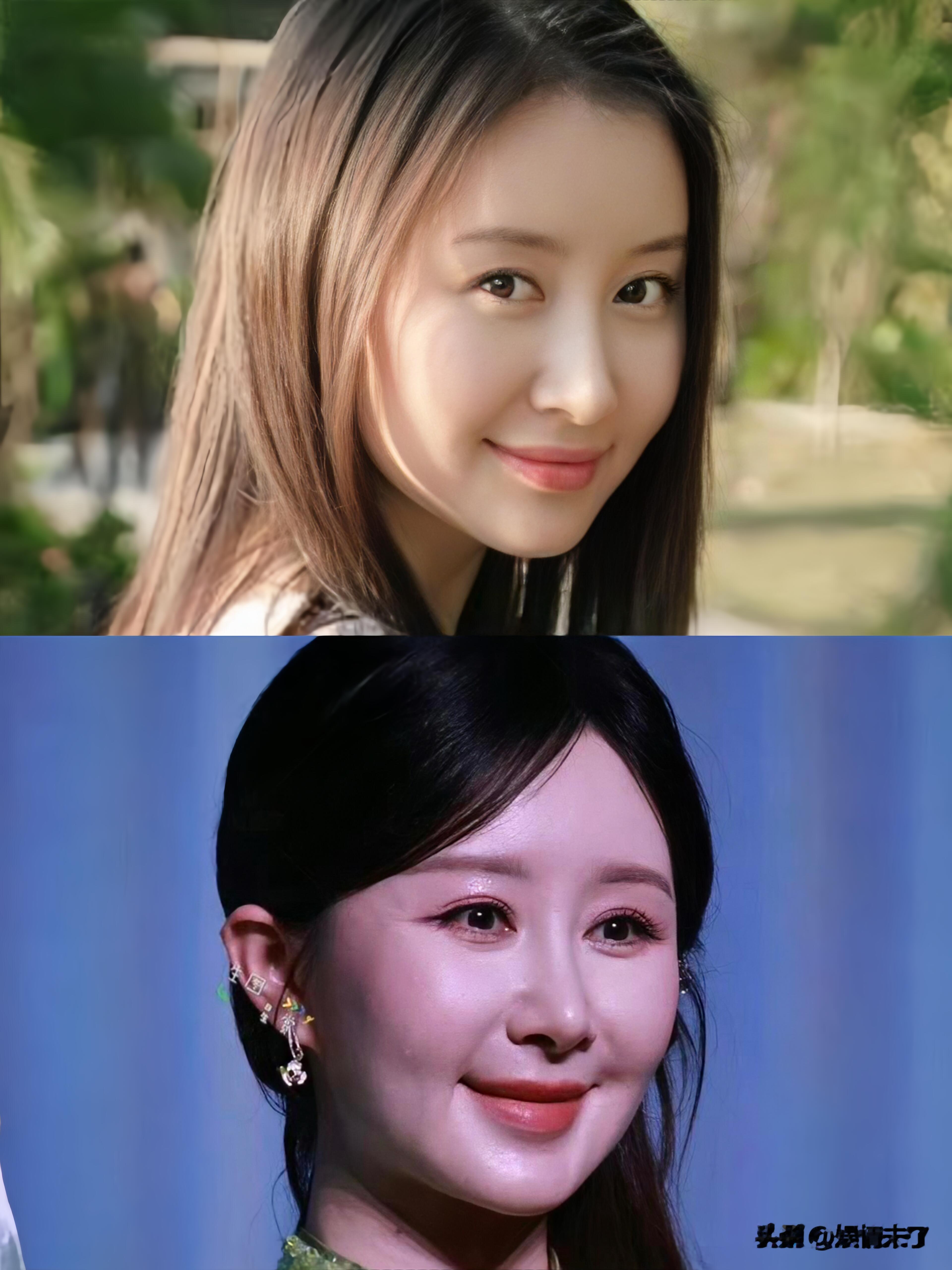 舒畅真的太让人觉得可惜了。本身底子就是大美女，明明可以从容优雅地慢慢老去，可偏偏选择过度医美。如今面