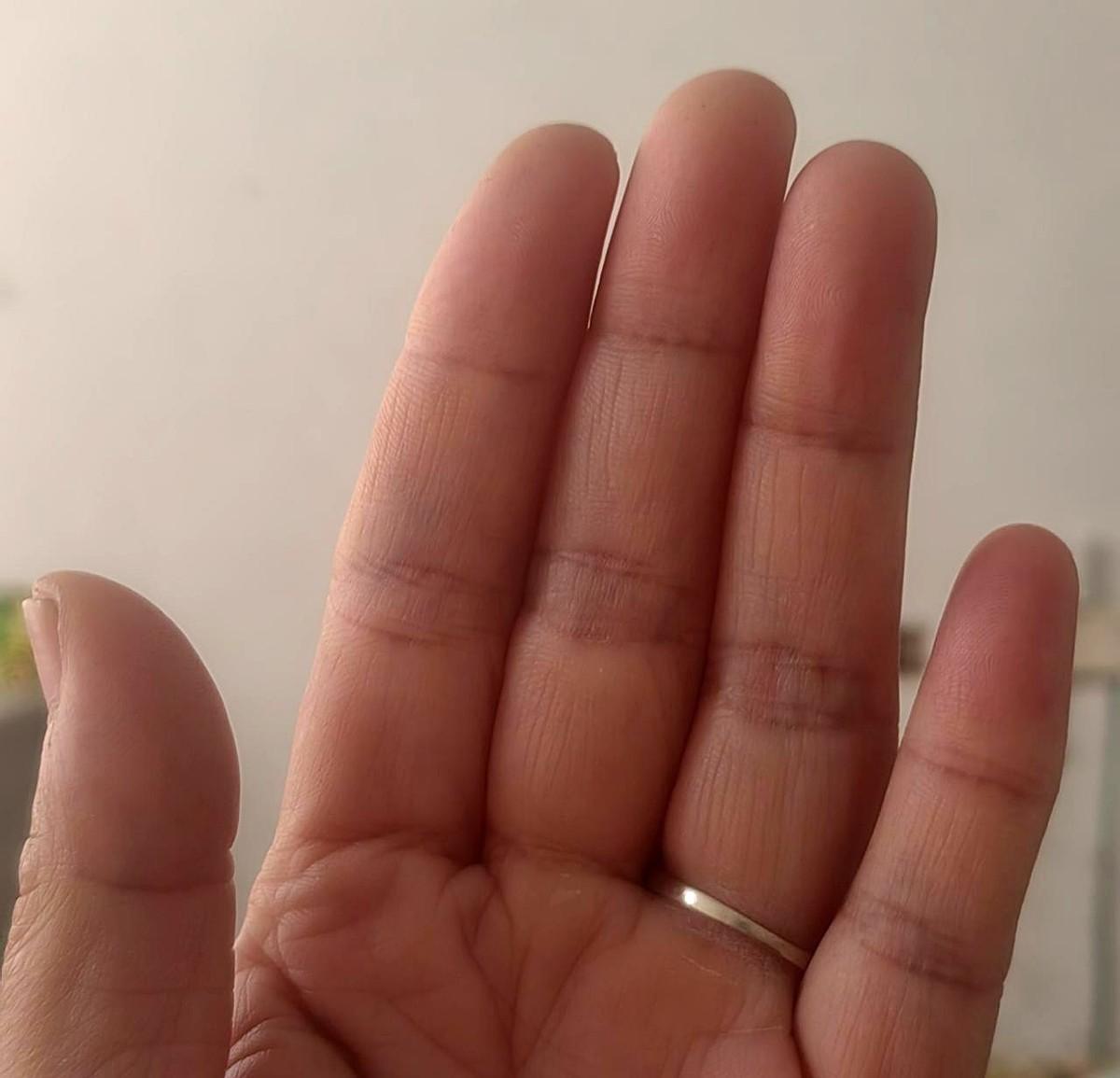 我就是两只手都是簸箕，没有斗的人。有这种手相的人大都命运多舛。我尽心尽力地照