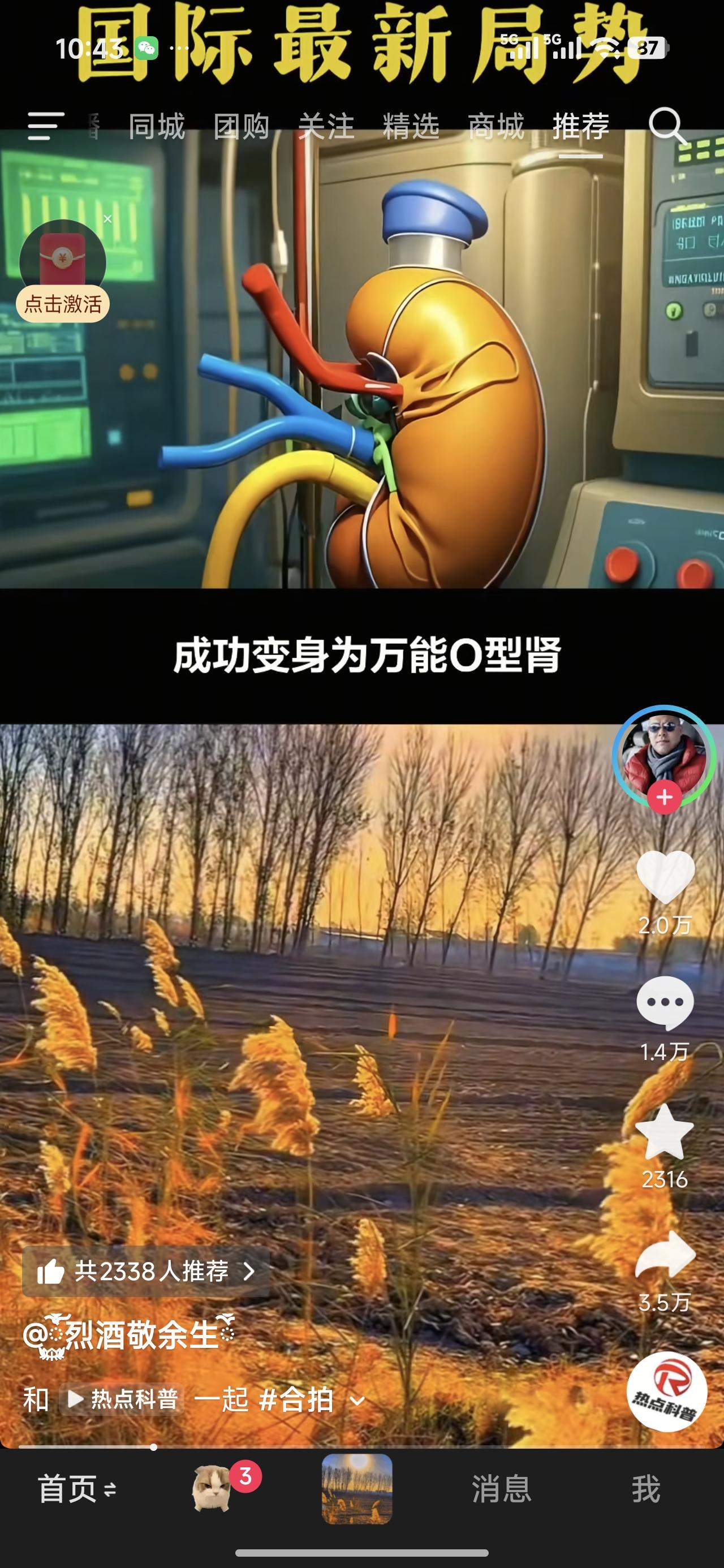 B型到0型，无缝对接。发了第三遍了，没法出去。自己看图说话吧！巨大的进步，国际