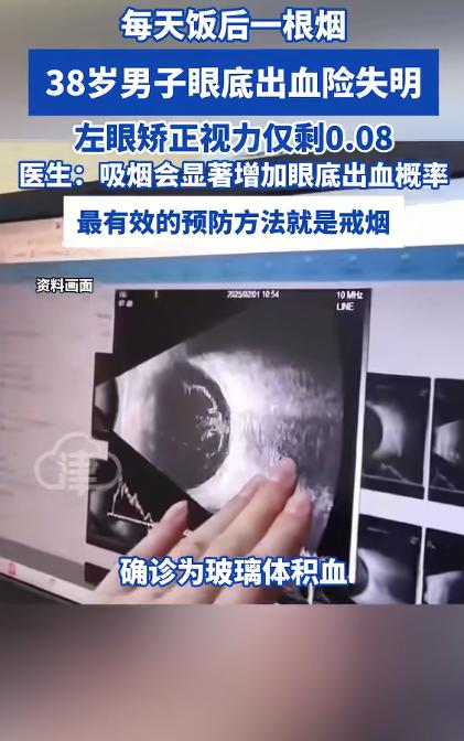 悲剧终究躲不过！4月29日武汉传来揪心一幕，湖北男子饭后抽一根烟，左眼突然