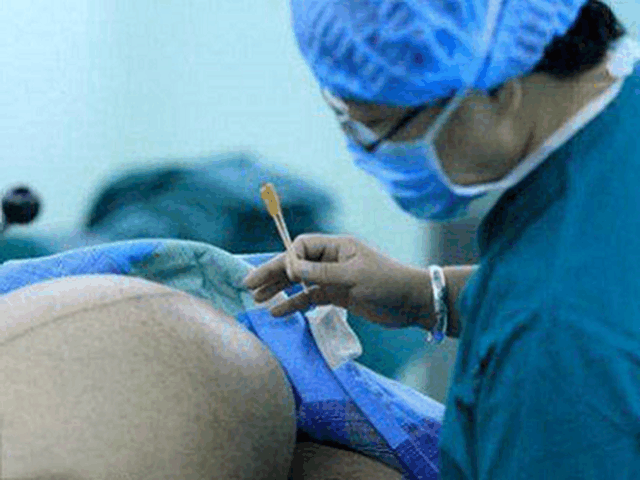 孕妇怀孕42周, 忽然喘不上气! 医生剖开肚子, 全产房都吓哭了, 咋了?