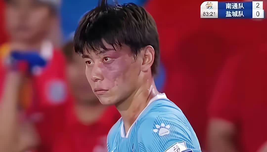 一边是“苏超”的业余球员庞志超，人称“青面兽”，眼里那股子坚定劲儿，还带着点狠辣