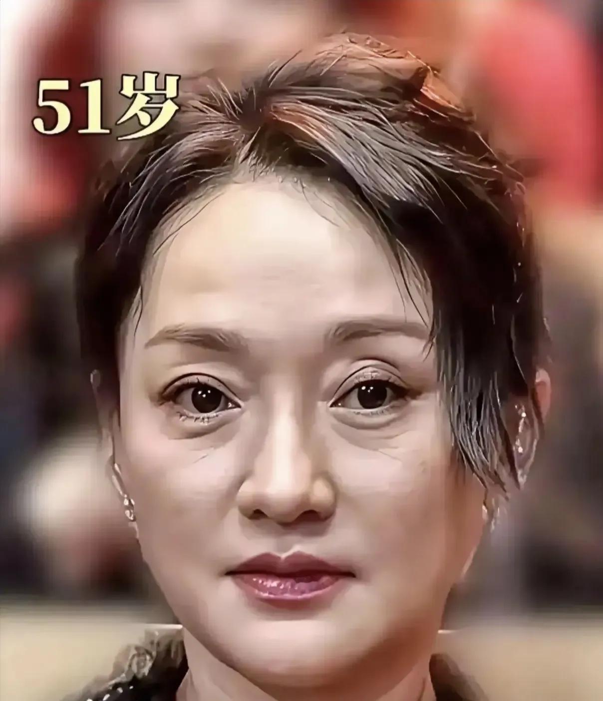 满头白发的周迅状态挺好，不信医美自然优雅老去活成了自己的女神看到周迅最近的照