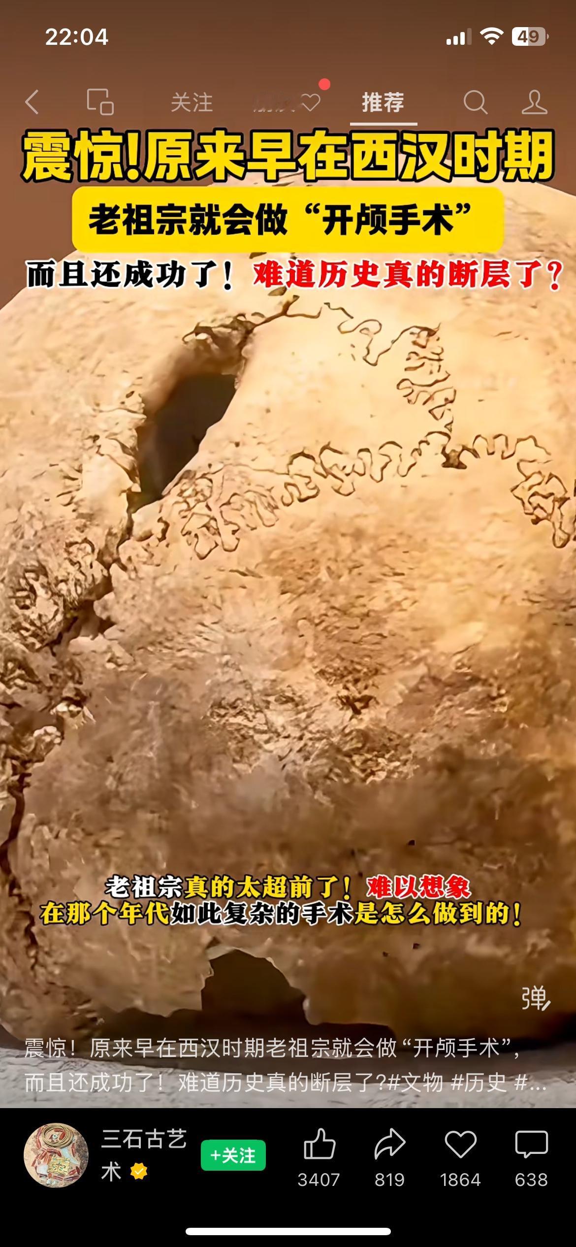 两千年前古墓出土头骨！古人的医疗水平真的被低估了（信息来源：北京市考古研究院）