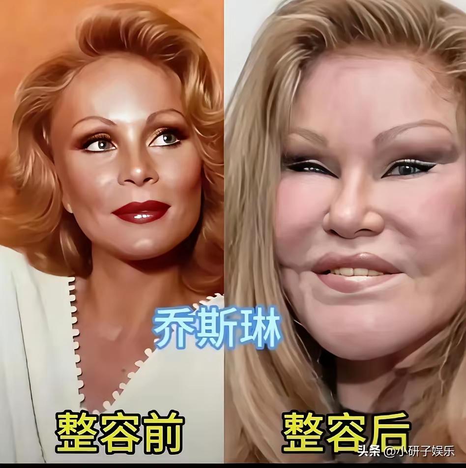 这些女明星估计肠子都悔青了吧！追求美固然是正确的，但是这种过度医美的脸真的是