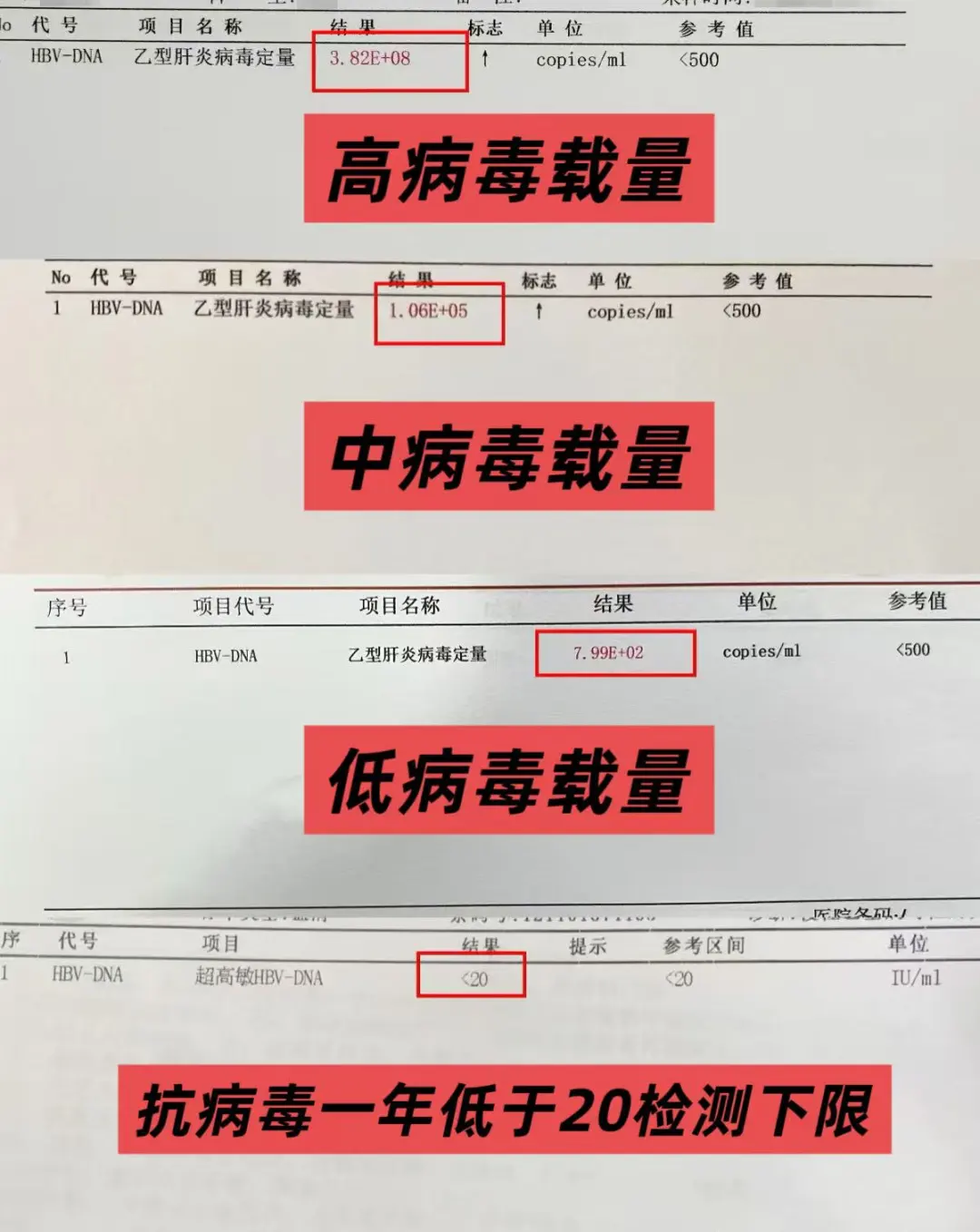 乙肝病毒量（HBV DNA）的高低可以反映病毒的复制活跃程度，但不同感...