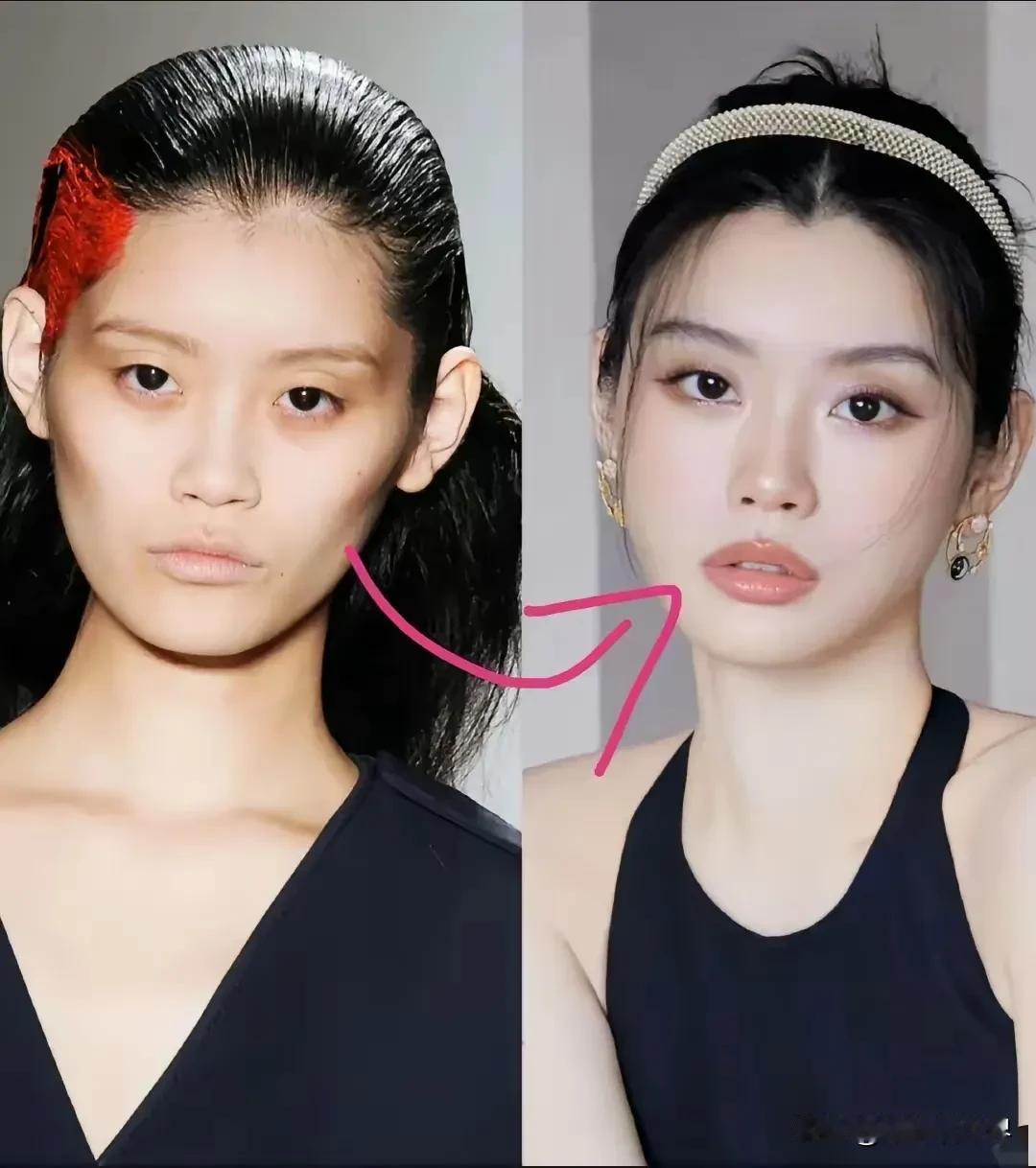 奚梦瑶还真不把我们当外人啊！她在节目里就大大方方自曝过自己也医美过，尤其是在脸上