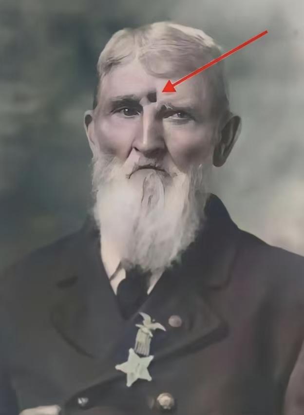 这才叫“阎王都不收”！美国老兵眉心中弹，带着子弹活了54年。那个时候的枪是滑