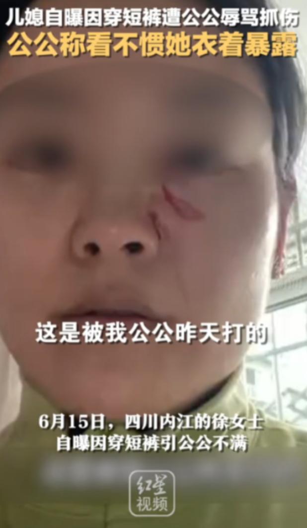 “清官难断家务事！”四川，一儿媳因天气热穿了条白色短裤，竟被50多岁的公公指着鼻