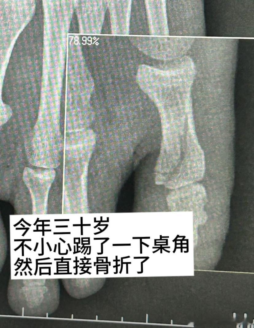 人到了三十岁就变得很脆皮​​​