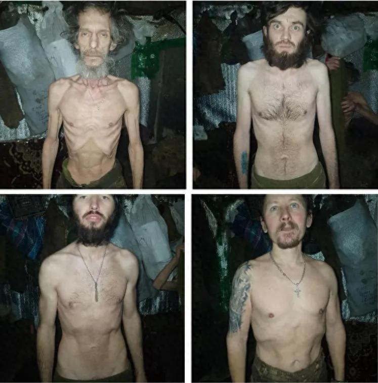 前线乌军惨照曝光！断粮17天饿成皮包骨，肋骨都看得清清楚楚，军方赶紧撤官甩锅！