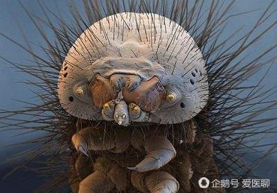 你知道怎么判断脸上有螨虫吗?